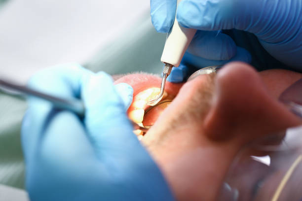 Best Knocked-Out Tooth Emergency  in Star, NC