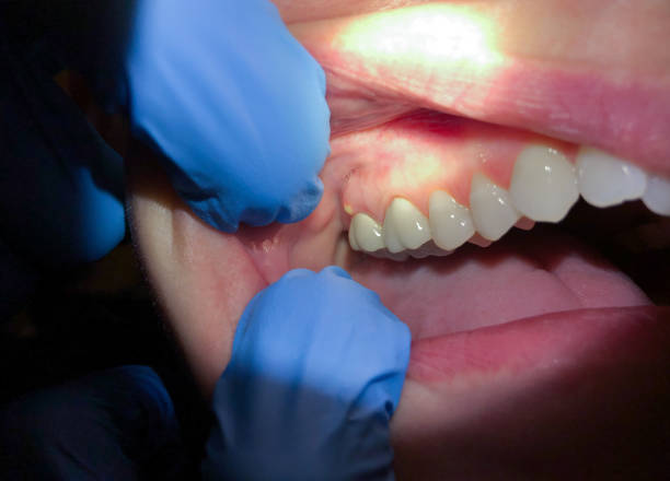 Best Knocked-Out Tooth Emergency  in Star, NC